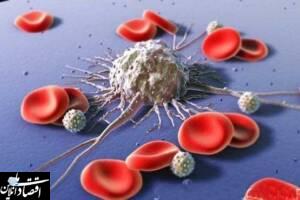 نکاتی که زنان در مورد سرطان پستان باید بدانند